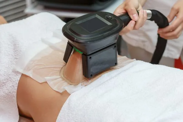 Image of person having fat freezing treatment to help weight gain Sedgley Park