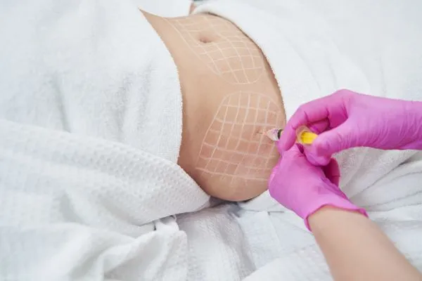 image of fat dissolving injections on love handles to help combat weight gain Sedgley Park