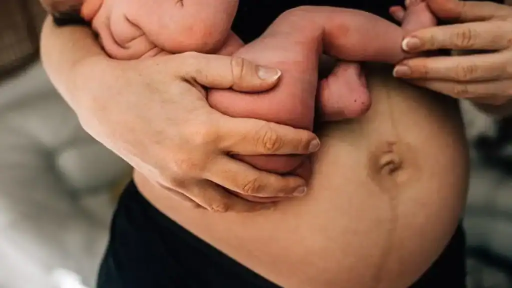 Why Is My Stomach Still Big After Pregnancy Sedgley Park?